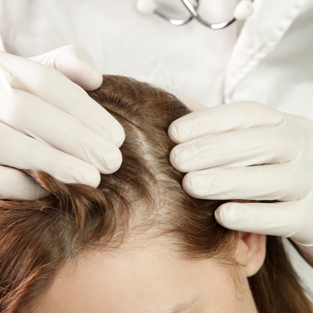 Flaky Scalp Fixes: Causes and Cures