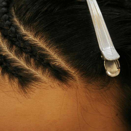 How to Stop Scalp Build‑Up & Boost Hair Health - Curldo