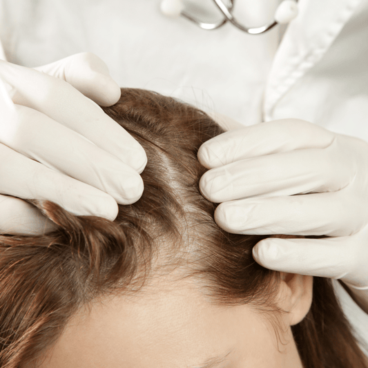 Flaky Scalp Fixes: Causes, Cures & Tips for Curly Hair - Curldo